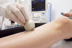 Un medico angiologo esegue un ecocolordoppler sugli arti inferiori di un paziente, disteso su un lettino all'interno di un centro medico