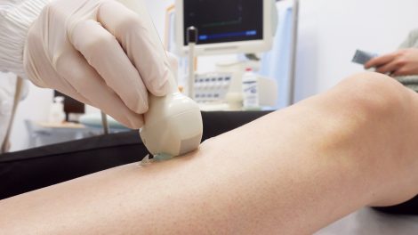 Un medico angiologo esegue un ecocolordoppler sugli arti inferiori di un paziente, disteso su un lettino all'interno di un centro medico