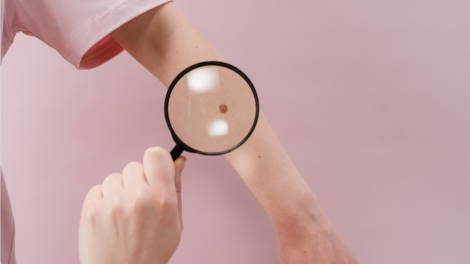 Un medico controlla i nei di un paziente