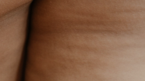 Foto di gambe con cellulite